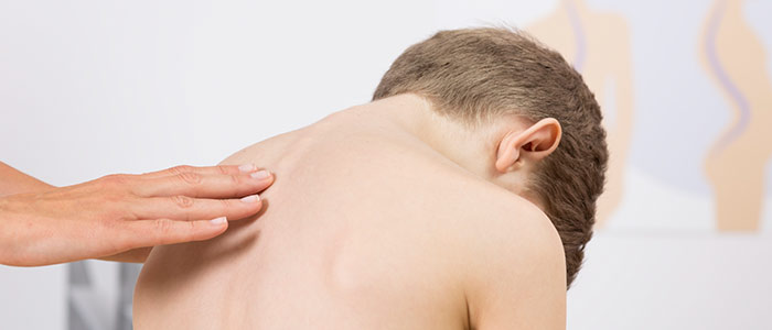 Chiropractic Care in Greenville For Scoliosis Relief